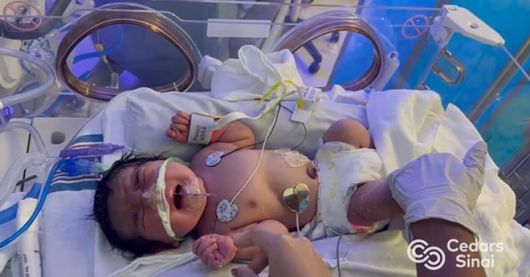 미국 캘리포니아에서 거대한 난소 종양 제거 수술을 앞두고 있던 한 여성이 임신 사실을 알게 된 뒤 며칠 만에 건강한 아기를 출산하는 기적이 일어났다. 사진=시더스-시나이 메디컬센터