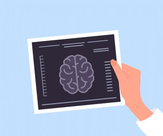 뇌 영상 검사(MRI)를 형상화한 일러스트. 신체 활동은 뇌 혈류와 구조에 영향을 미쳐 치매 위험을 낮출 수 있는 요인으로 분석됐다. 123rf