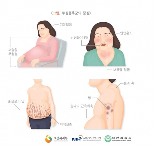 문화뉴스