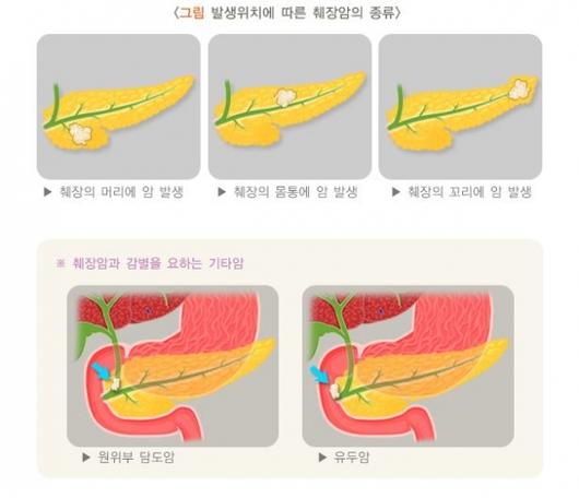 문화뉴스