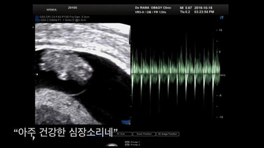 엑스포츠뉴스