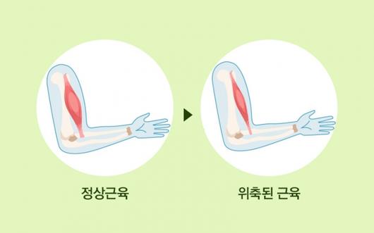 머니투데이