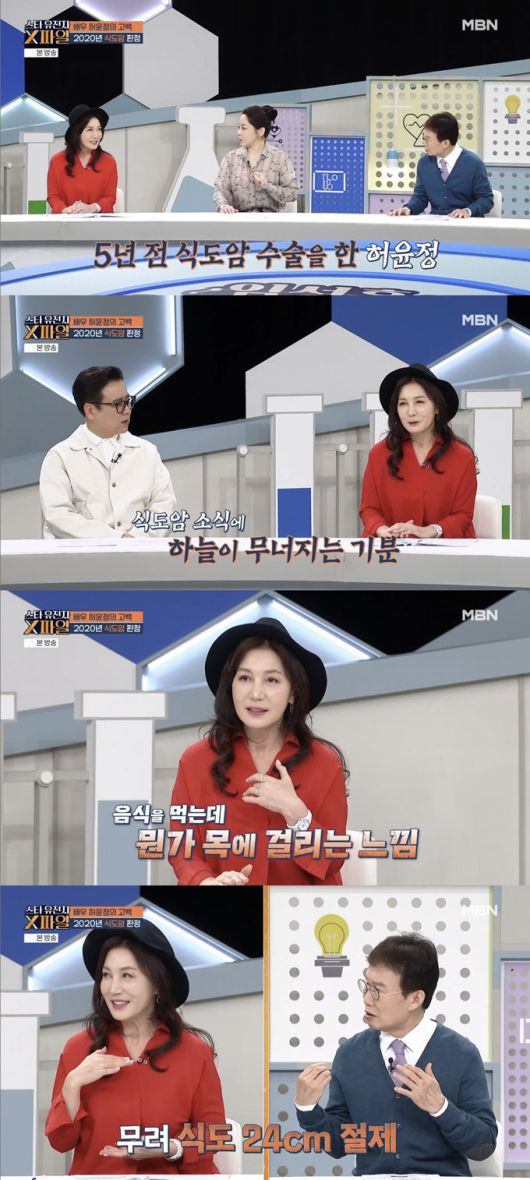 배우 허윤정이 식도암 투병으로 고생한 이야기를 털어놨다./사진=MBN '임성훈의 스타 유전자 X파일' 방송 화면