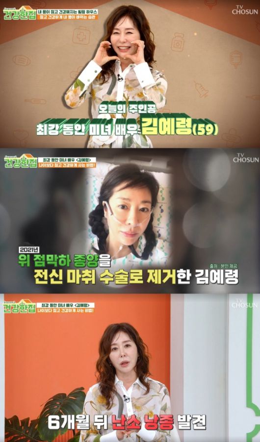 배우 김예령이 세 차례나 전신 마취 수술을 진행했다고 밝혔다. /사진=TV조선 '건강한집' 시즌2 방송화면