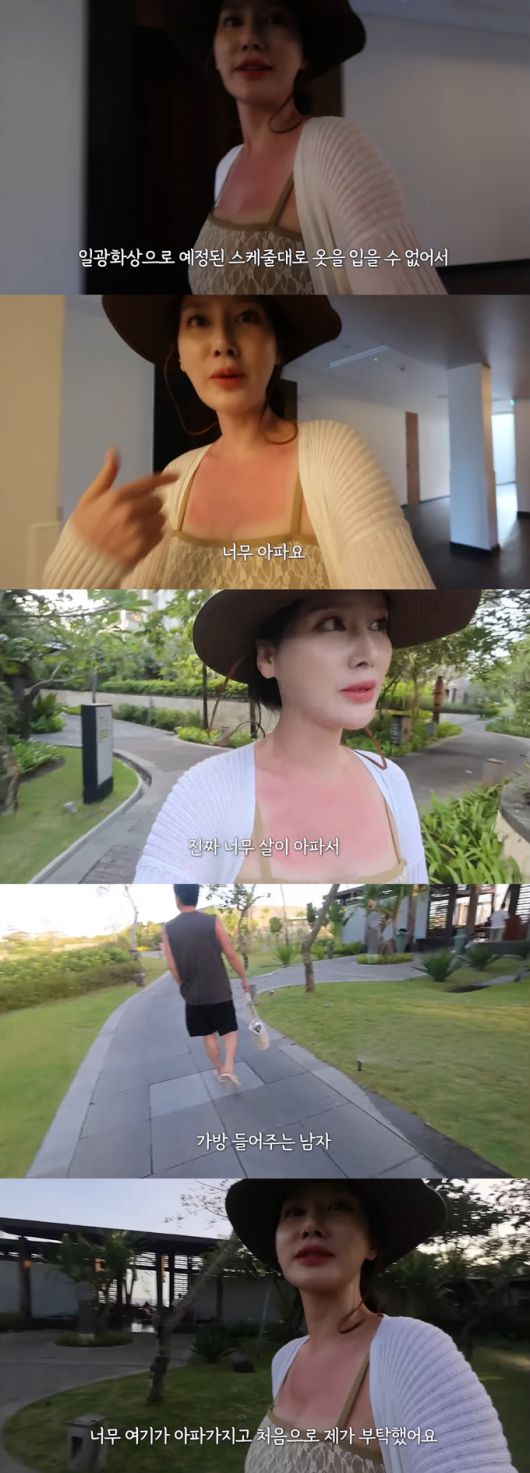 미스코리아 출신 방송인 이혜원이 여행 중 입은 화상 통증을 호소했다./사진=유튜브 채널 '제2혜원' 영상