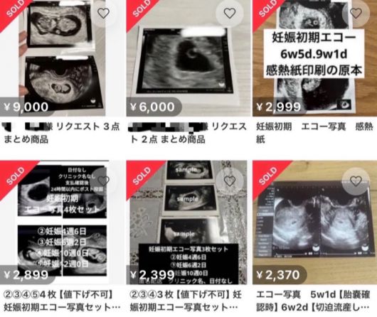 일본의 중고거래 플랫폼 메루카리에 게재된 태아 초음파 거래 자료사진./사진=온라인 SNS(소셜미디어) 화면캡쳐.