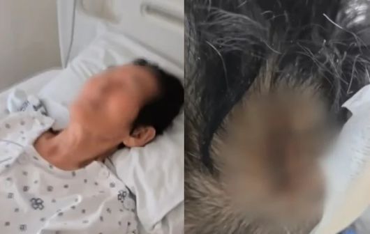 8살 아이와 부딪혀 머리와 허리 등을 다친 A씨 모친. /사진=JTBC 사건반장