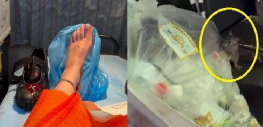 신주쿠에서 쥐에 물려 치료 받은 여성/사진=인스타그램 'yogitutty' 갈무리