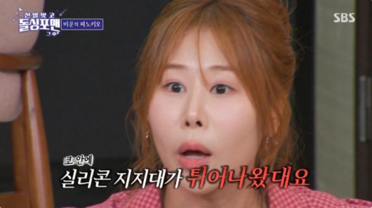 박세미가 코 안에 실리콘 지지대가 무너진 과거를 고백했다. /사진=SBS '신발 벗고 돌싱포맨' 캡처