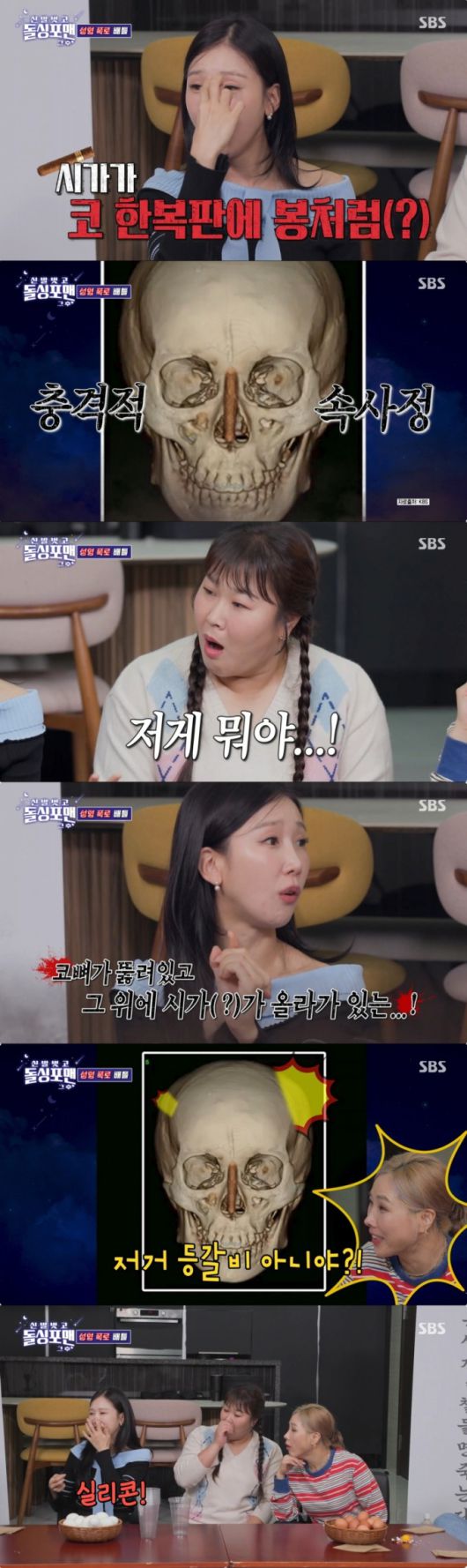 실리콘이 보이는 CT사진을 공개한 박소영. /사진=SBS '신발 벗고 돌싱포맨' 캡처