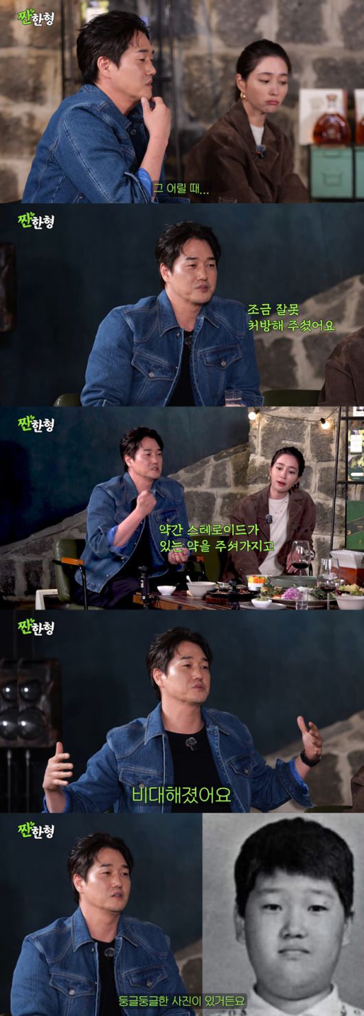 배우 유지태가 어린 시절 복용한 피부과 약의 스테로이드 부작용으로 체중이 많이 나갔었다고 고백했다./사진=유튜브 채널 '짠한형 신동엽' 영상