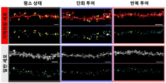 학습 이후 단백질 억제제 투여 방식에 따른 시냅스 변화 사진. dual-eGRASP는 서로 다른 신경세포 집단에서 유래한 시냅스를 색으로 구분해 시각화하는 기법으로, 동일한 신경세포에 형성된 시냅스의 기원을 구별해 관찰할 수 있다. 위 이미지에서는 엔그램 세포에서 유래한 시냅스가 노란색으로, 비엔그램 세포에서 유래한 시냅스가 청록색으로 표시돼 있다. 단백질 합성 억제제를 한 차례 투여한 경우와 반복적으로 투여한 경우에서 엔그램 유래 시냅스의 분포와 형태가 서로 다르게 나타난다. IBS