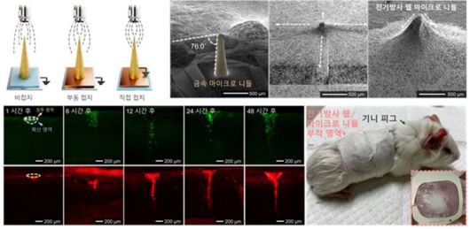 전기방사 웹 마이크로 니들의 제작 결과 및 약물 전달 결과. 한국기계연구원