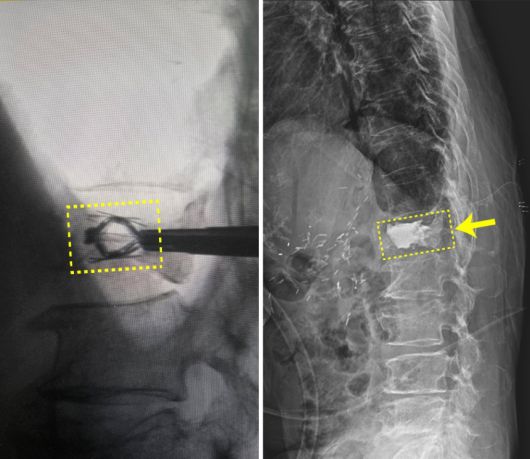[힘찬병원 제공]
