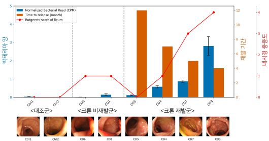 [세브란스 제공]
