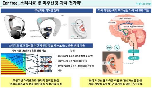 이명치료용 디지털 치료기기