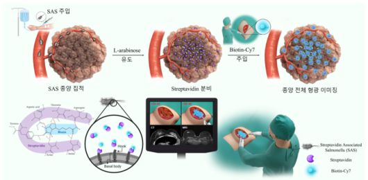 형광 가이드 수술 모식도