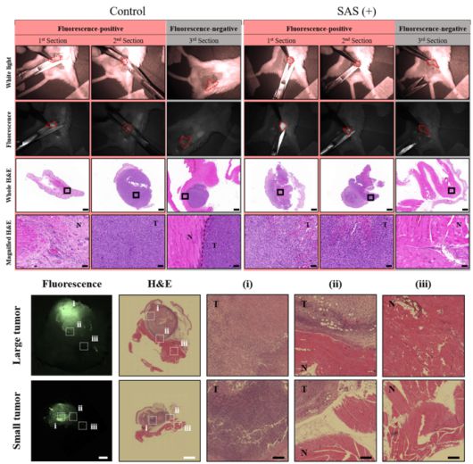 형광 가이드 수술에서의 조직 분석