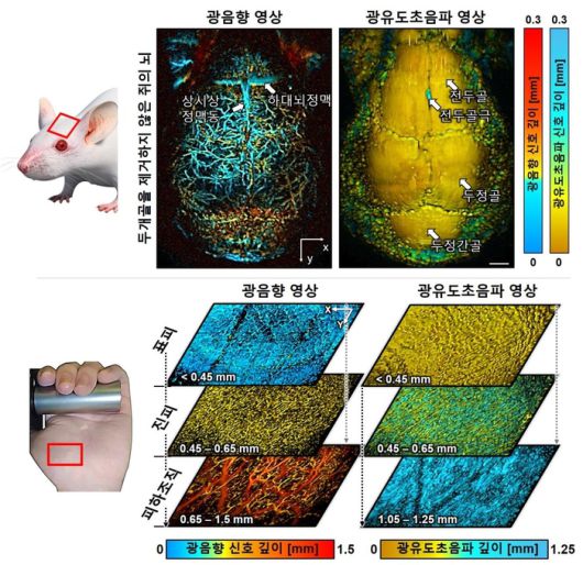 생체 내 쥐 뇌 및 사람 손에서의 광음향/광유도초음파 동시 영상 결과
