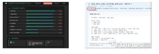서울아산병원 '의료 딕셔너리 기반 RAG·쿼리 엔진 위드 웍스봇