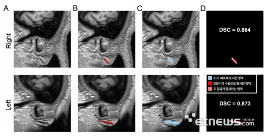 3차원 원본 이미지(A)를 토대로 전문가가 수동으로 직접 표시한 주름(B)과 AI가 예측해 자동으로 표시한 영역(C)
