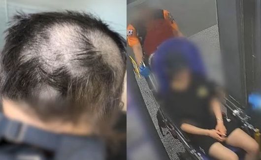 20대 초반의 한 여성이 남자친구에게 감금돼 폭행과 강간을 당했다. / MBC 보도화면 갈무리