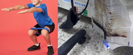 태국의 한 고등학생이 고강도 체별을 받고 소변색이 콜라처럼 어두워져 병원을 찾았다. 사진출처=SNS, 게티이미지뱅크