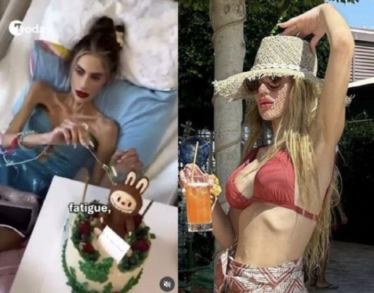 튀르키예 유명 인플루언서 니할 칸단(30)이 심각한 거식증을 앓다가 사망했다. (사진=인스타그램 캡처)