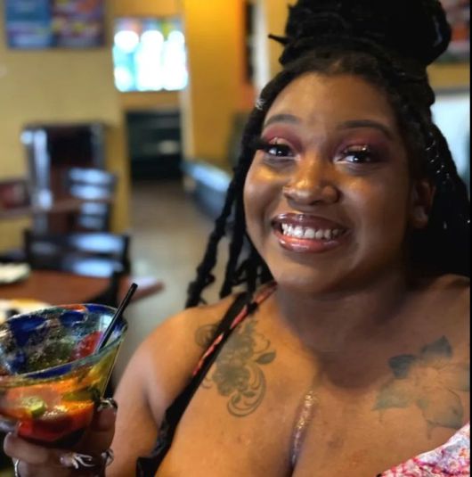 수술로 켈로이드를 제거 하고 환한 미소를 짓고 있는 샬라마르. 출처=더선