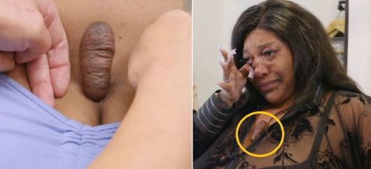 가슴에 생긴 켈로이드 흉터로 인해 대인 기피증까지 겪었던 미국 여성 샬라마르. 출처=더 선