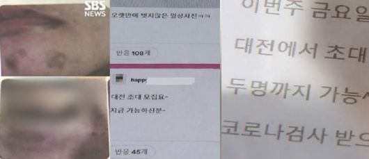 B씨가 남편으로부터 폭행을 당한 뒤 찍었다고 주장한 증거 사진(왼쪽), 남편 A씨가 온라인에서 남성들을 모집한 글. 출처=SBS뉴스 갈무리
