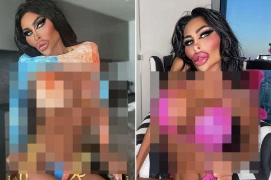 '인간 바비'가 되기 위해 과도한 성형수술을 받은 호주 여성이 화제다. 사진=더선