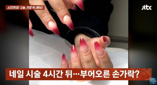 네일 시술을 받은 한 외국인 여성이 손가락에 문제가 생긴 것처럼 조작한 인공지능(AI) 이미지로 환불과 진료비를 요구했다는 사연이 전해졌다. /사진=JTBC '사건반장' 캡처