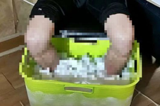 보험금을 타기 위해 몸을 동여맨 채 드라이아이스에 10시간 동안 발을 담갔다가 끝내 양다리만 절단한 대만 남성. 사진은 범행 당시 모습. ET투데이 캡처