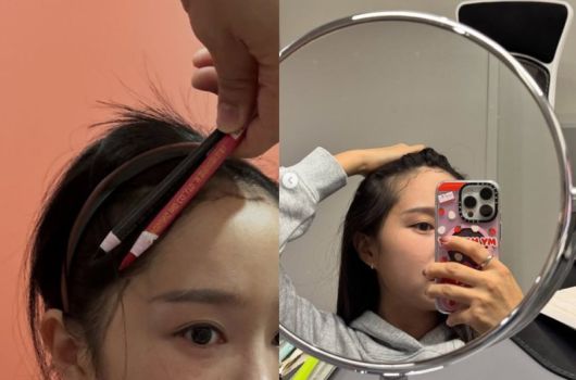 키즈 콘텐츠로 인기를 끄는 크리에이터 헤이지니가 새해를 맞아 모발이식 에피소드를 공유했다. 뮤지컬에 출연하며 두피와 모발에 강한 자극을 지속적으로 준 결과 헤어라인이 망가져 모발이식을 결심했다고. 사진=뉴시스