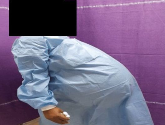 40대 여성이 배에 복수가 가득 차 배가 불룩하게 튀어나온 수술 직전 모습. 사진=큐어스(cureus)