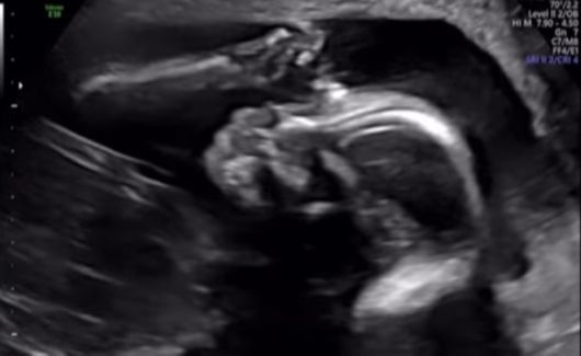 사진 출처=임정희 계정