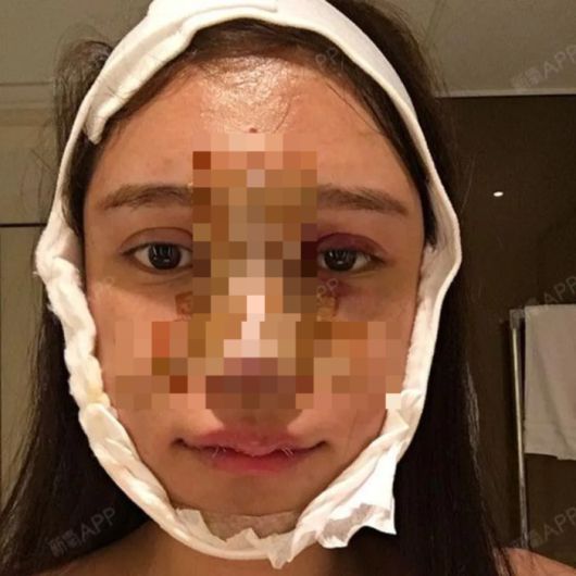 에비는 성형 수술 ‘여정’을 자신의 SNS에 공유하고 있다. [사진 = BBC]