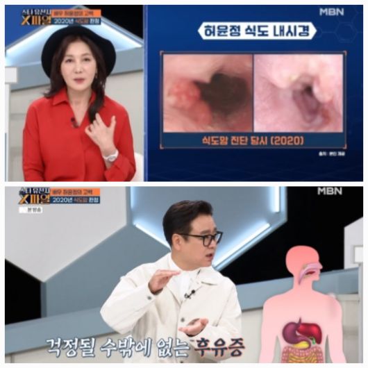 허윤정은 이날 방송에서 아버지가 3년간 후두암 투병 끝에 세상을 떠났던 경험도 함께 나눴다.사진= MBN ‘임성훈의 스타 유전자 X파일’