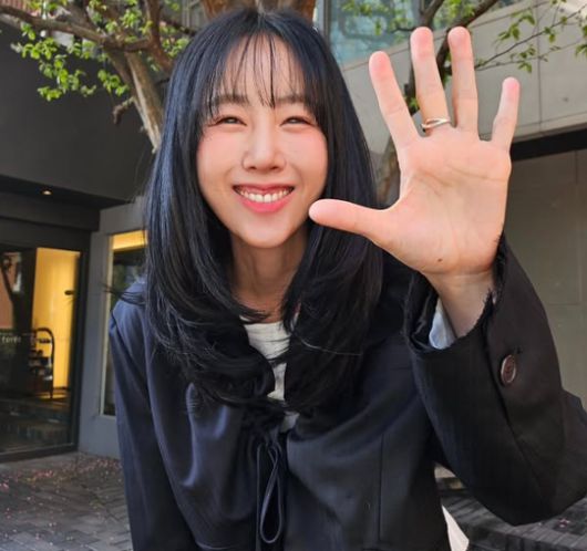 별이 건강 문제로 활동을 일시 중단한다고 알렸다. 사진=별 SNS