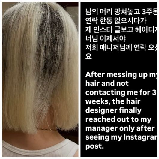 거울 속 모습이 낯설고, 머리를 감을 때마다 두려워졌다.사진=DJ 소다 SNS