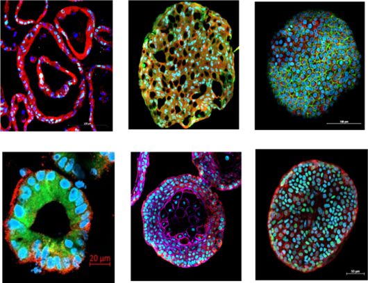 왼쪽 위부터 시계방향으로 비강, 기관지, 폐, 간, 췌장, 소장 오가노이드. 한국 기업인 넥스트앤바이오는 다양한 기관의 오가노이드를 연구개발하고 있다. [넥스트앤바이오]