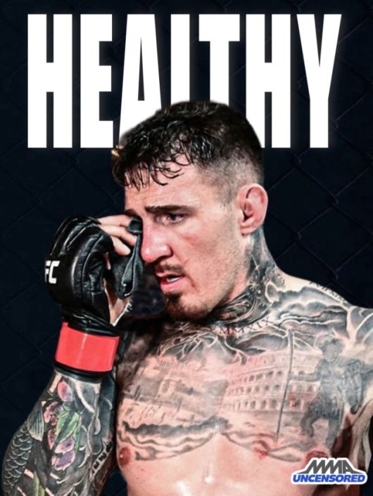 불행 중 다행히 아스피날의 눈 부상은 크지 않은 듯하다. 사진=MMA UNCENSORED SNS