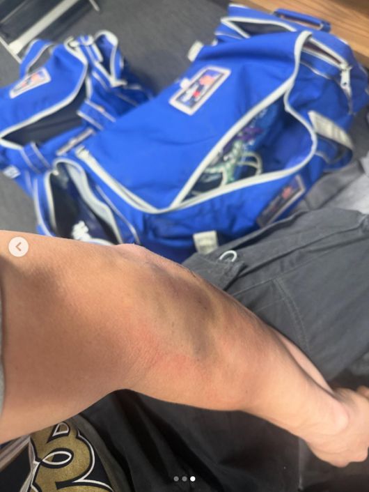 키케 에르난데스는 왼팔꿈치 부상을 참고 포스트시즌을 뛰었다. 사진= 키케 에르난데스 인스타그램.