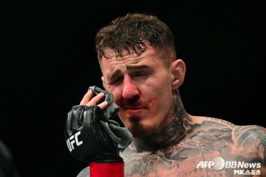 아스피날이 자신의 SNS를 통해 간을 향한 선전포고를 했다. 그는 “사랑과 응원, 그리고 밈들에 감사하다. 헤이터들은 필요 없다. 거대한 반칙꾼에게 복수하러 간다”고 전했다. 사진=AFPBBNews=News1