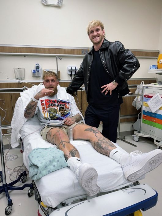 폴은 조슈아전 이후 “턱이 부러진 것 같다. 확실히 부러졌다. 역대 최고 중 한 명에게 제대로 한 대 맞았다”고 이야기했다. 사진=X