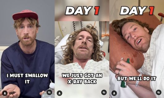 직접 커피 원두를 먹고 배설물을 활용해 장난치려던 코미디언 마이클 브룩하우스. [사진 출처 = 마티 앤 마이클(MartyandMichael) 인스타그램 캡처]