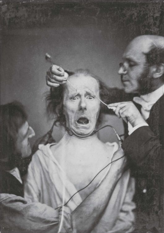 뒤센과 그의 조수가 노인의 얼굴 근육을 자극하여 표정이 만들어지는 과정을 시연하고 있다. 뒤센은 표정이 인간의 본질적 감정으로 영혼과 연관되어 있다고 믿었다. 그는 입꼬리와 눈주름으로 만들어지는 표정을 ‘진정한 행복’의 표현이라고 주장했다.