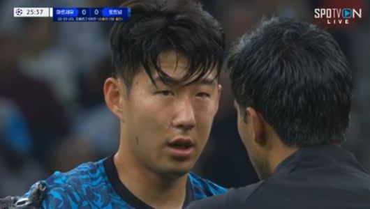 안면부상을 당해 교체아웃되는 손흥민(가운데). EPA=연합뉴스