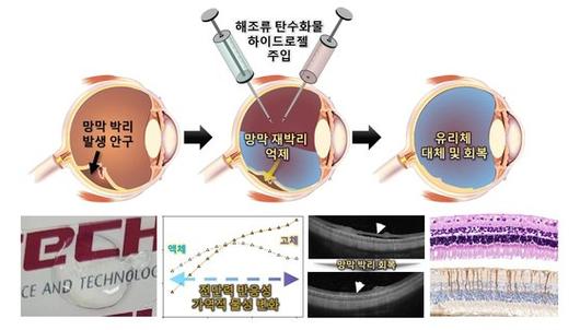 중앙일보